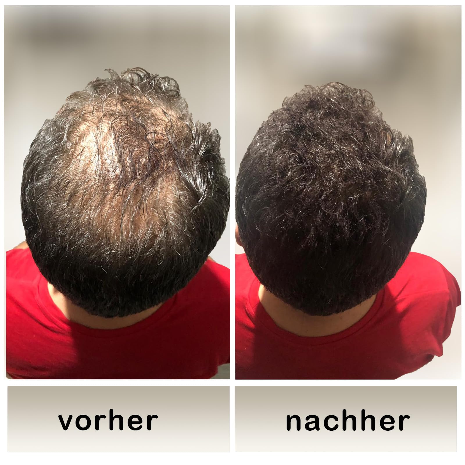 Color One Ansatzpuder wirkt sofort und st?rkt Ihre Haarfasern. Color One Streuhaar zur Haarverdichtung & vollem Haar in Sekunden. (Braun)