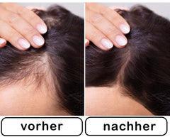 Color One Ansatzpuder wirkt sofort und st?rkt Ihre Haarfasern. Color One Streuhaar zur Haarverdichtung & vollem Haar in Sekunden. (Braun)