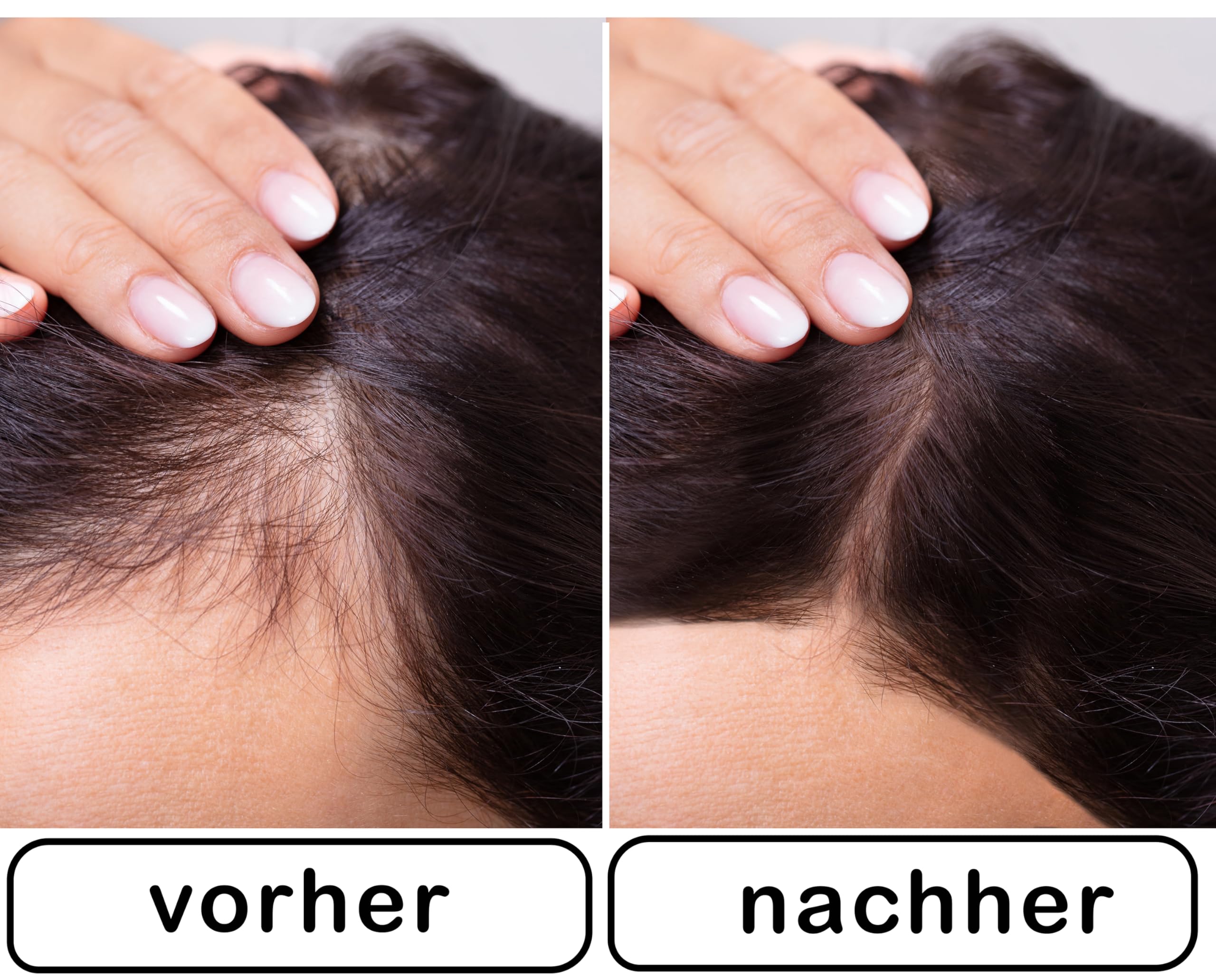 Color One Ansatzpuder wirkt sofort und st?rkt Ihre Haarfasern. Color One Streuhaar zur Haarverdichtung & vollem Haar in Sekunden. (Hellbraun)